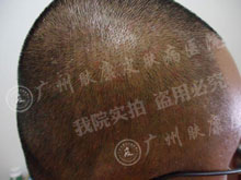 广州肤康皮肤病医院